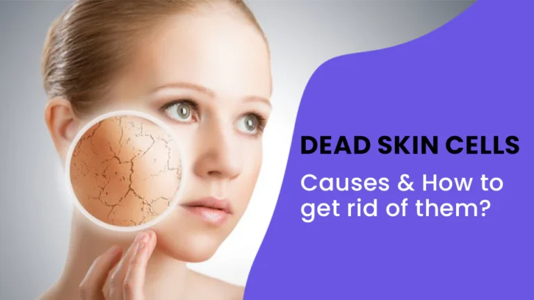 Dead Skin Cells